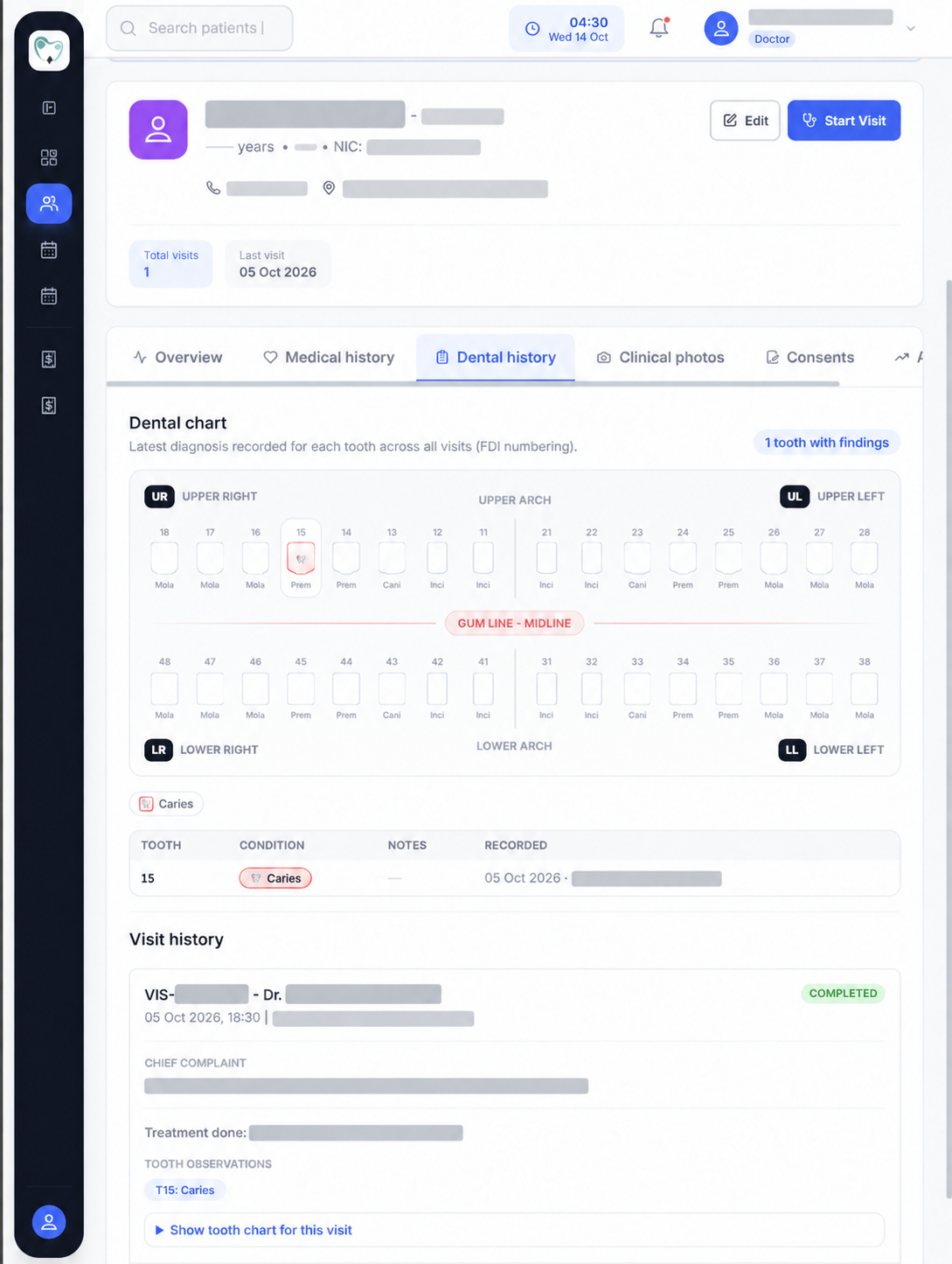 Anonymized patient dental history view with tooth chart and visit timeline